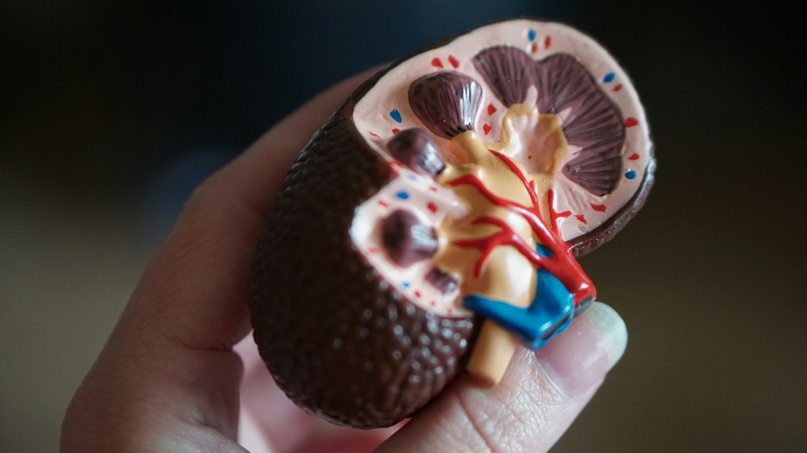 Kidney Transplant